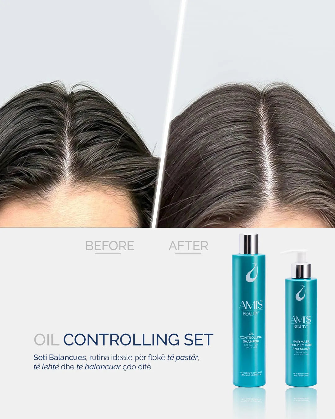 Shampoo & mask oil controlling